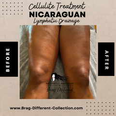 Nicaraguan Lymphatic Drainage Massage & Postop Care Services