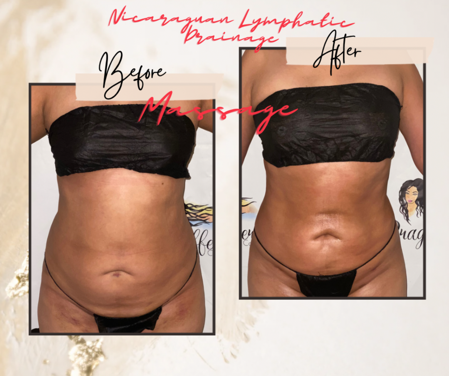 Nicaraguan Lymphatic Drainage Massage, (Inflammation Reduction) Cosmetic & Medical Post Surgical Care
