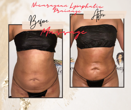 Nicaraguan Lymphatic Drainage Massage & Postop Care Services